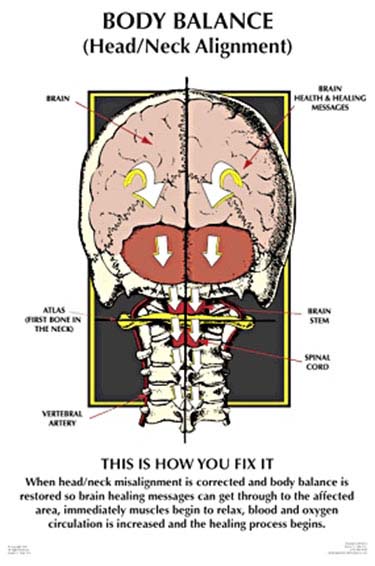 Chiropractic Troy MI Nucca Body Balance