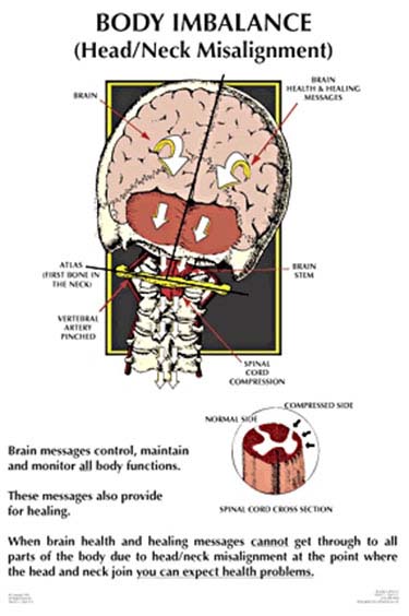 Chiropractic Troy MI Nucca Body Imbalance