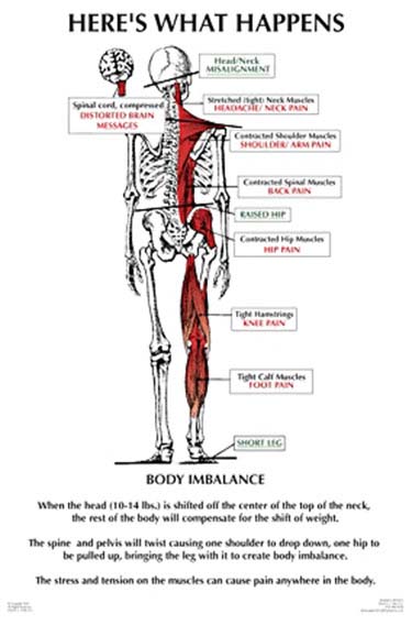 Chiropractic Troy MI Nucca What Happens