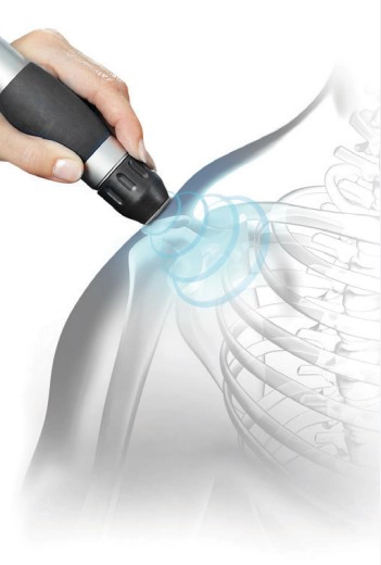Chiropractic Troy MI Radial Pressure Wave Therapy Shoulder